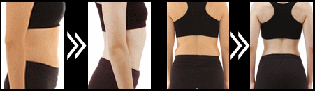 ライザップ 女性