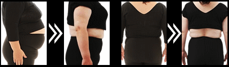 ライザップ 女性3